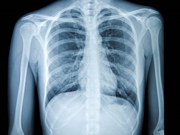 orthopedic malpractice