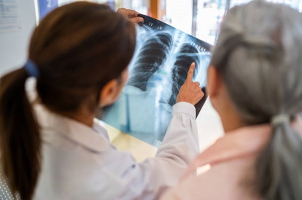 Radiology illustration