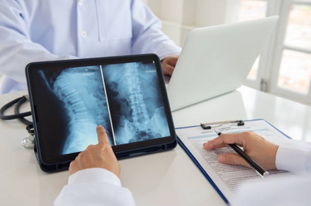paralysis x ray